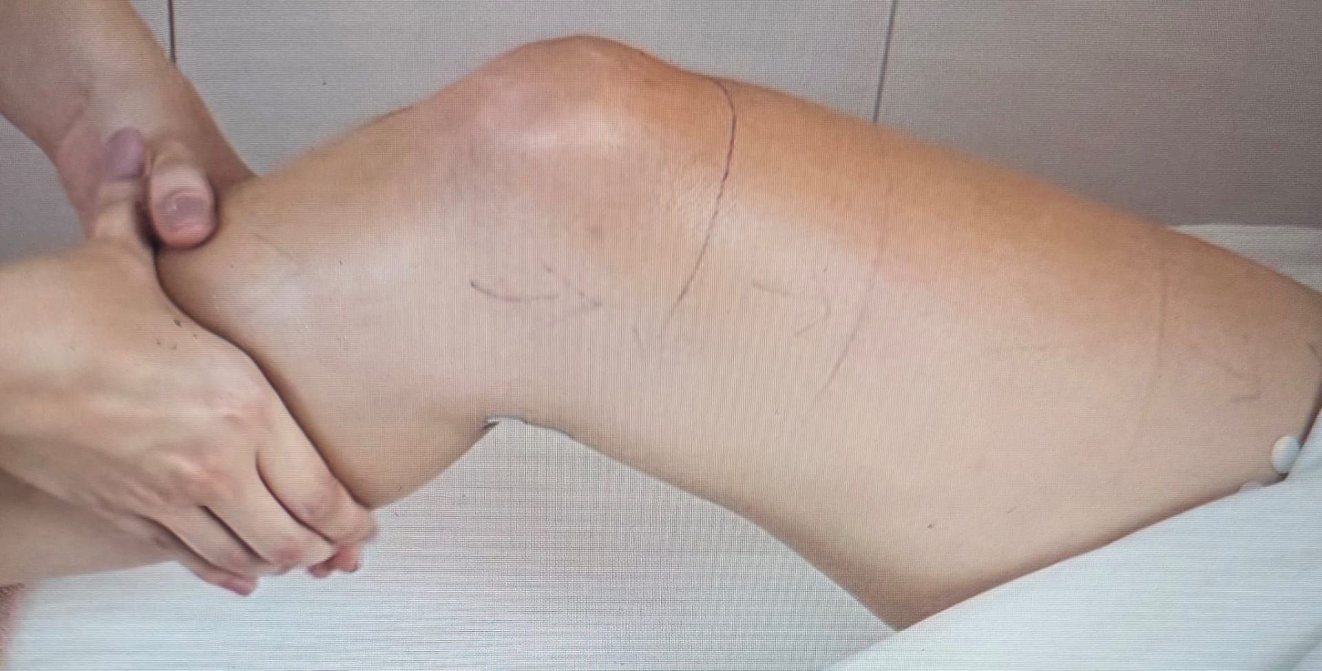 Lymphedema & Oncology Care